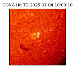 gong - 2025-07-04T10:00:10