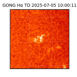 gong - 2025-07-05T10:00:11