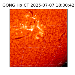 gong - 2025-07-07T18:00:42