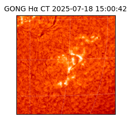 gong - 2025-07-18T15:00:42