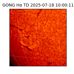 gong - 2025-07-18T10:00:11