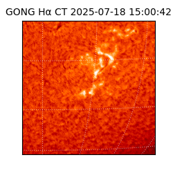 gong - 2025-07-18T15:00:42