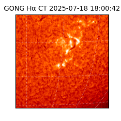 gong - 2025-07-18T18:00:42