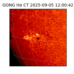 gong - 2025-09-05T12:00:42