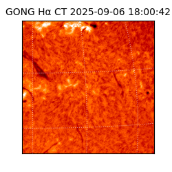 gong - 2025-09-06T18:00:42
