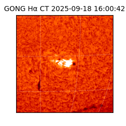 gong - 2025-09-18T16:00:42