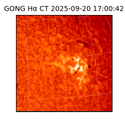 gong - 2025-09-20T17:00:42