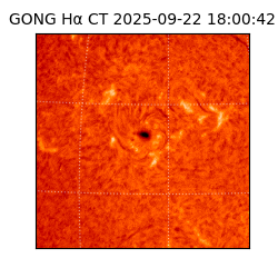 gong - 2025-09-22T18:00:42