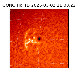 gong - 2026-03-02T11:00:22