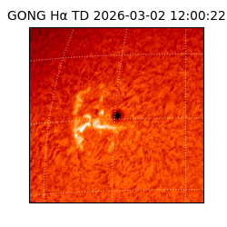 gong - 2026-03-02T12:00:22