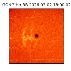 gong - 2026-03-02T18:00:02