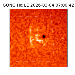 gong - 2026-03-04T07:00:42