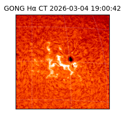 gong - 2026-03-04T19:00:42