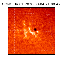 gong - 2026-03-04T21:00:42