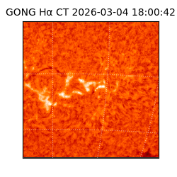 gong - 2026-03-04T18:00:42