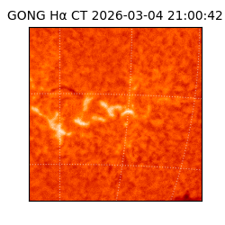 gong - 2026-03-04T21:00:42