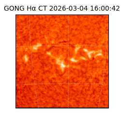 gong - 2026-03-04T16:00:42