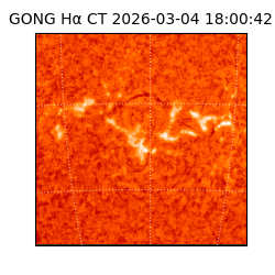 gong - 2026-03-04T18:00:42