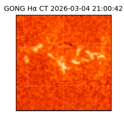 gong - 2026-03-04T21:00:42