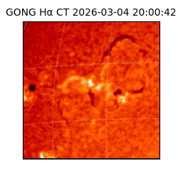 gong - 2026-03-04T20:00:42