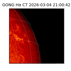 gong - 2026-03-04T21:00:42