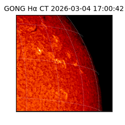 gong - 2026-03-04T17:00:42