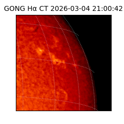 gong - 2026-03-04T21:00:42