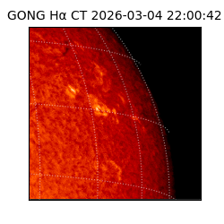 gong - 2026-03-04T22:00:42