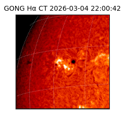 gong - 2026-03-04T22:00:42