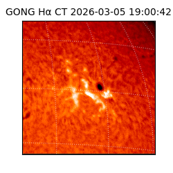 gong - 2026-03-05T19:00:42