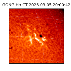 gong - 2026-03-05T20:00:42