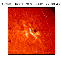 gong - 2026-03-05T22:00:42