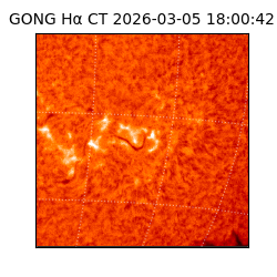 gong - 2026-03-05T18:00:42