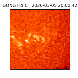 gong - 2026-03-05T20:00:42