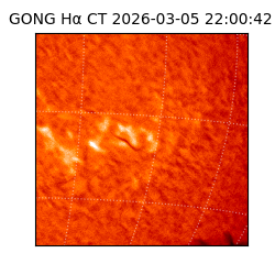 gong - 2026-03-05T22:00:42