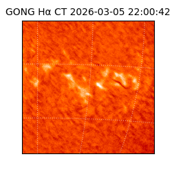 gong - 2026-03-05T22:00:42