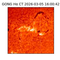 gong - 2026-03-05T16:00:42
