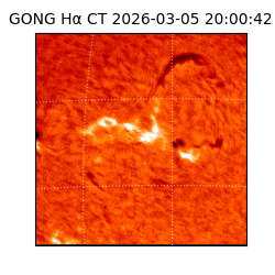 gong - 2026-03-05T20:00:42