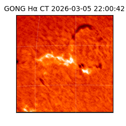 gong - 2026-03-05T22:00:42