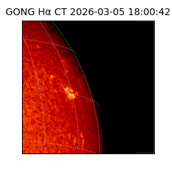gong - 2026-03-05T18:00:42