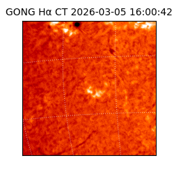 gong - 2026-03-05T16:00:42