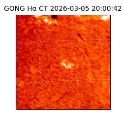 gong - 2026-03-05T20:00:42