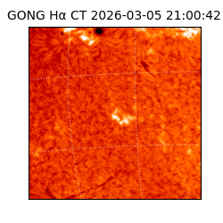 gong - 2026-03-05T21:00:42