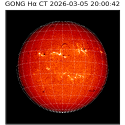 gong - 2026-03-05T20:00:42