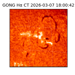 gong - 2026-03-07T18:00:42