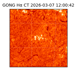 gong - 2026-03-07T12:00:42