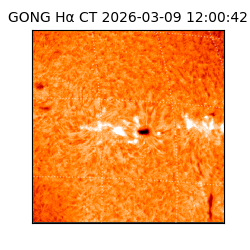 gong - 2026-03-09T12:00:42