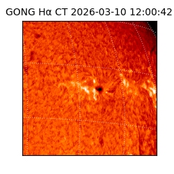 gong - 2026-03-10T12:00:42