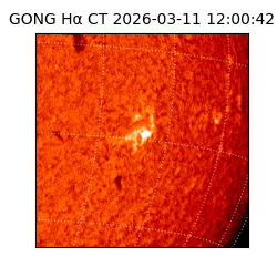 gong - 2026-03-11T12:00:42