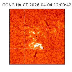 gong - 2026-04-04T12:00:42